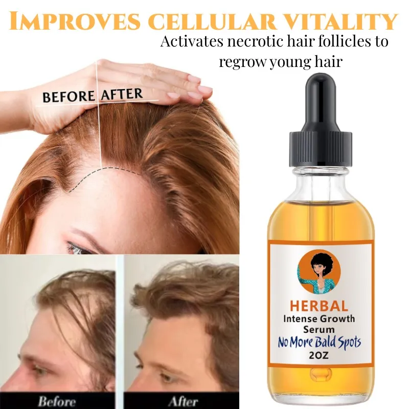 

Hair Growth Oil Serum Promote Hair Growth Prevent Loss Thinning Repair Dense Damaged Follicles Care Hair Treatment Essential