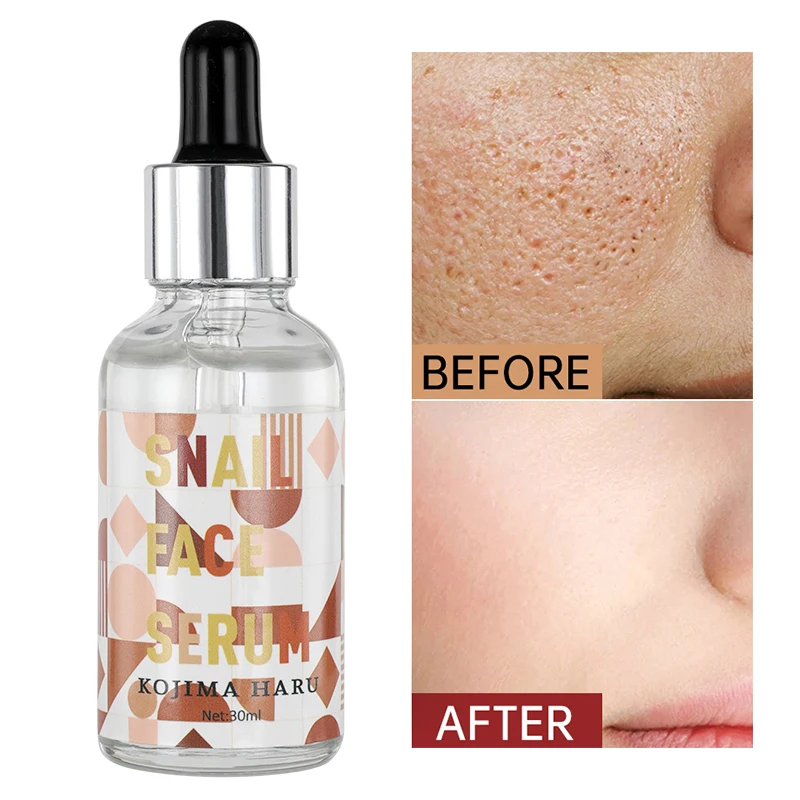 

30ml Snail Serum,Anti Aging & Deep Wrinkles,Heals And Repairs Skin, Instantly Ageless For Face