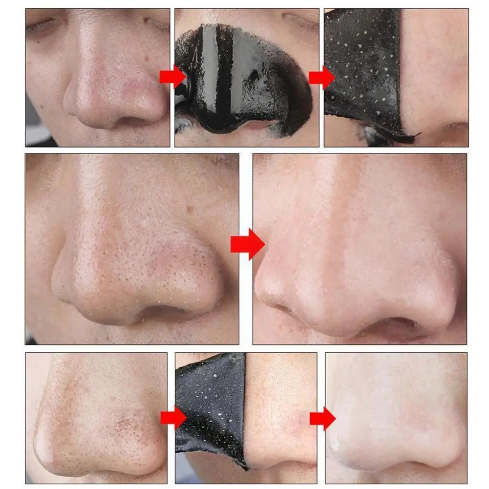 

Black Peel Off Mineral Mud Nose Blackhead Deep Mud Nose Strips Nose Pore Mineral Cleansing Remover W6h6