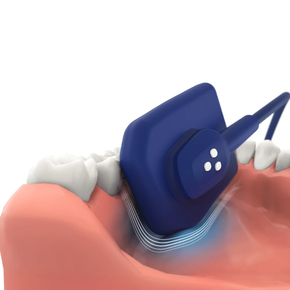 Аппарат радиовизиографический ezsensor vatech dental manufacturing ltd корея