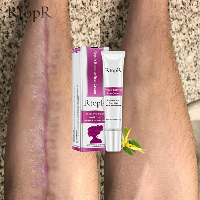 

RtopR Acne Scar Stretch Marks Remover Cream Skin Repair Face Cream Acne Spots Acne Treatment Blackhead Whitening Cream Skin Care