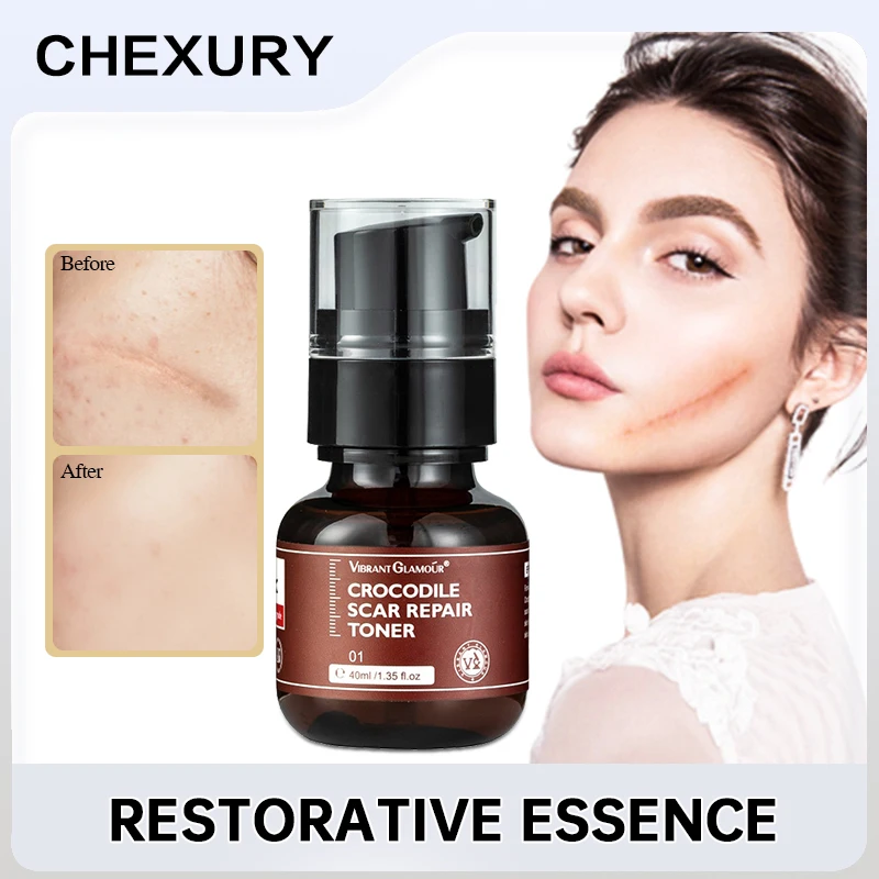 

Эссенция для восстановления рубцов крокодила, устраняет рубцы, осветляет цвет шрама и уменьшает рубцы, продукция для ухода за кожей