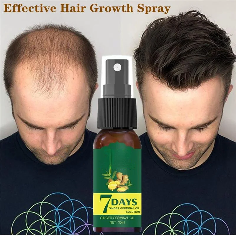 

7 Days Ginger Hair Growth Spray Oil Men Women Fast Promote Hair Grow Thicker Anti Hair Loss Scalp Treatment Nourish Hair