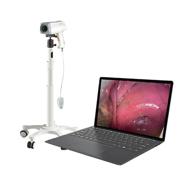 Ручной кольпоскоп ccd SD Digital Colposcope kn-2200 для гинекологии осмотра влагалища