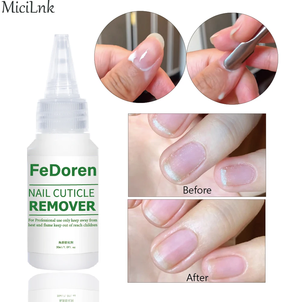 

Жидкий отшелушиватель для удаления кутикулы ногтей, 30 мл