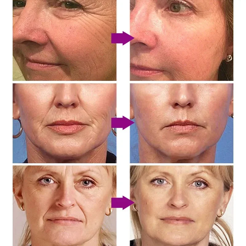 Средство для удаления морщин и ретинола Мерцающая Сыворотка лица жидкость