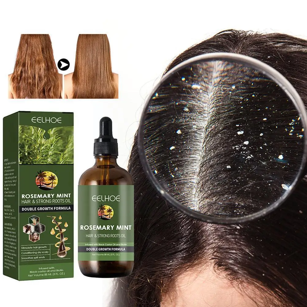 

Гладкое шелковистое масло розмарина для ухода за волосами восстанавливающее эфирное масло восстанавливающее выпадение волос сыворотка для поврежденных волос масло против ухода G6M2