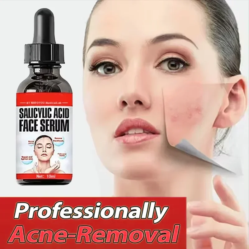 Эссенция раствора салициловой кислоты сужение пор и пятен от прыщей удаление