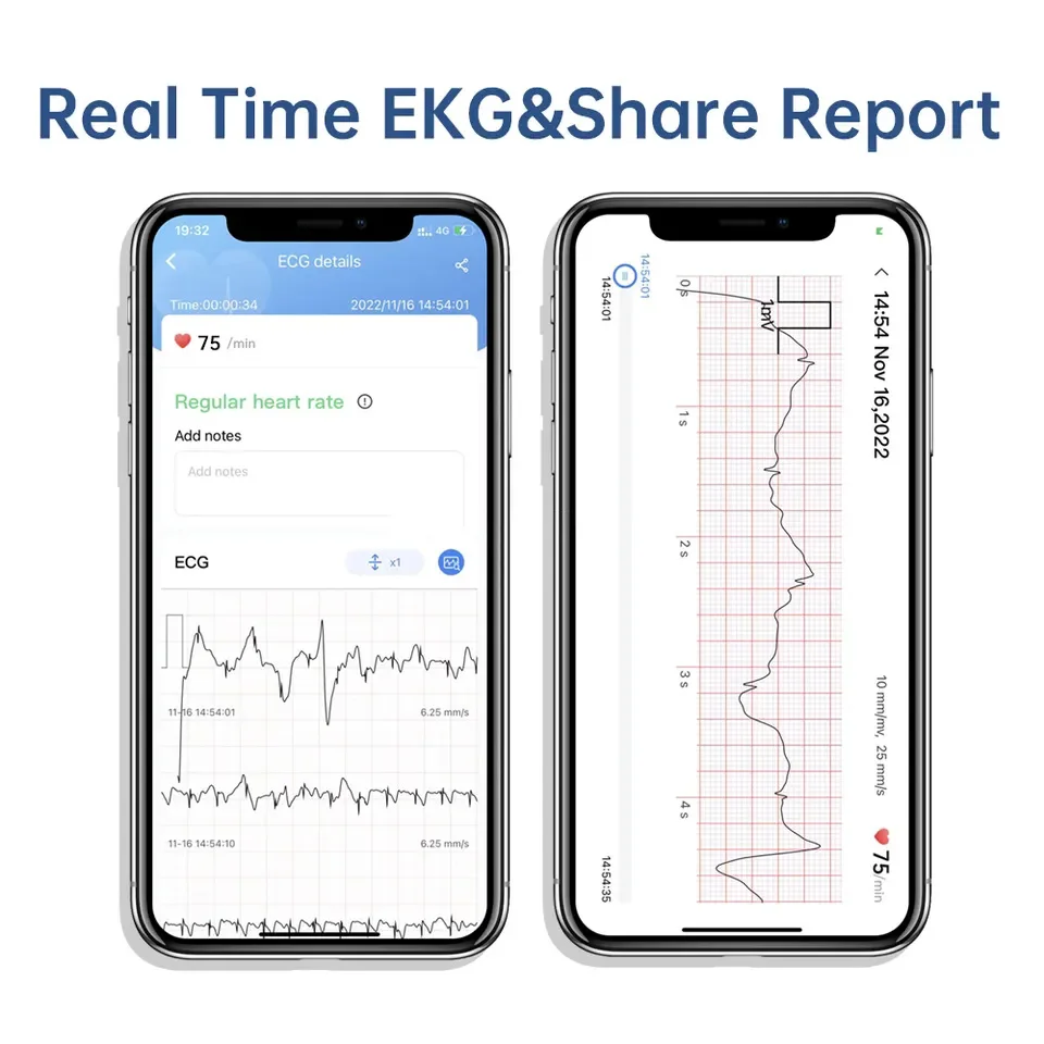 Электрокардиограф EKG Медицинский Регистратор Беспроводной Монитор Электрокардиографической Машины с Bluetooth.