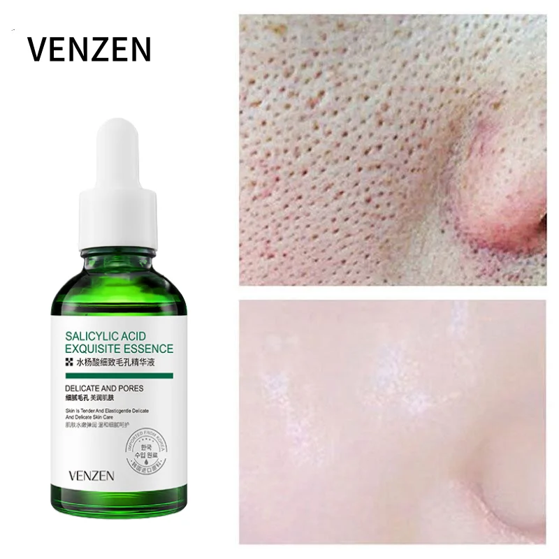 

Сыворотка для сужения пор с салициловой кислотой, поры лицо твердая эссенция, осветление, лечение акне, контроль жирности, увлажнение, отбел...