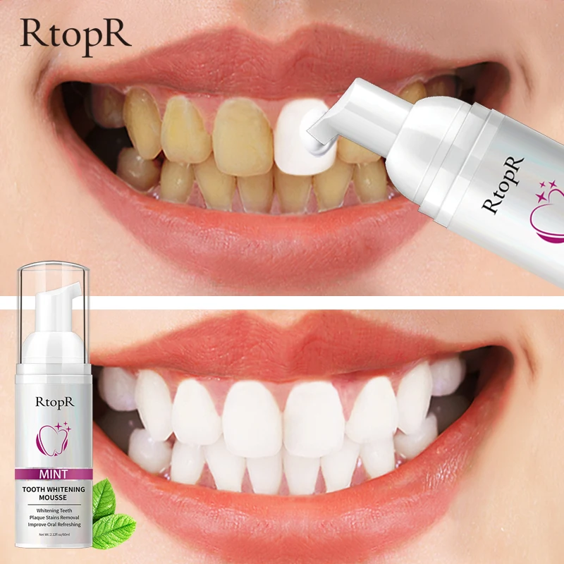 

RtopR Teeth Whitening Cleansing Mousse Tartar Removes Stains Teeth Oral Hygiene Mousse Toothpaste Whitening and Staining 60ml