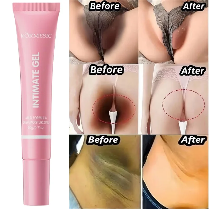 Отбеливающий крем отбеливающая сыворотка для интимных частей подмышек