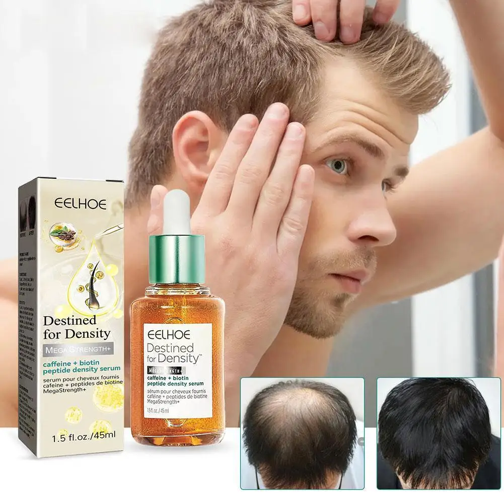 

EELHOE Fast Hair Follicle Treatment hair Prevent Hair Baldness Hair loss Damaged Hair Care Nourish Thicker Loss X3N8