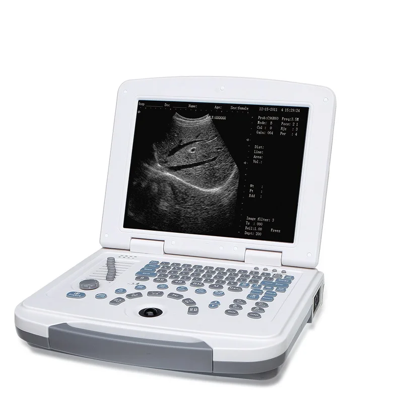 

Human color hand-hold medical ultrasound instruments Digital portable ultrasound