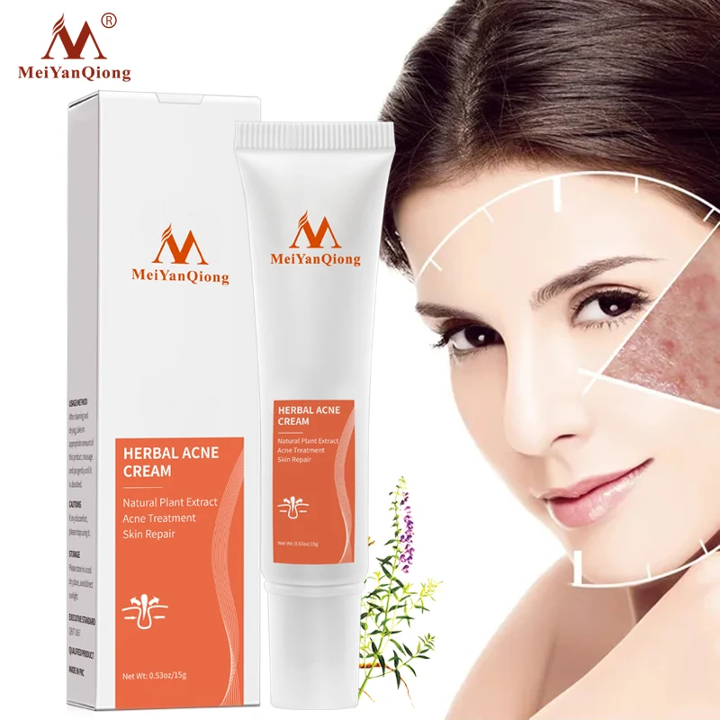 

MeiYanQiong High Quality Herbal Cleansing Face Anti acne treatment cream Herbal scar removal oily skin Acne Spots skin care face