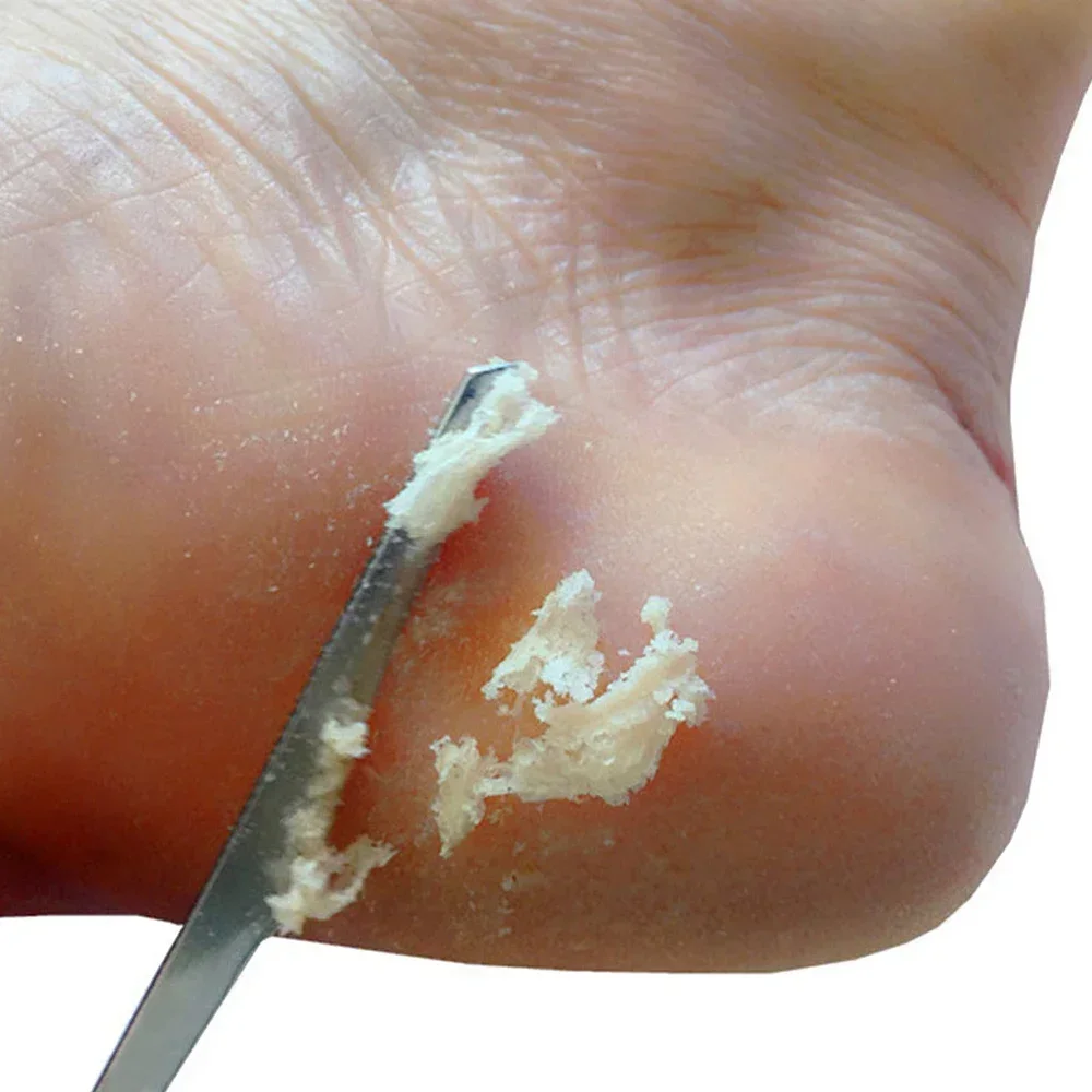 1/2/5 шт. скребок для ног из нержавеющей стали