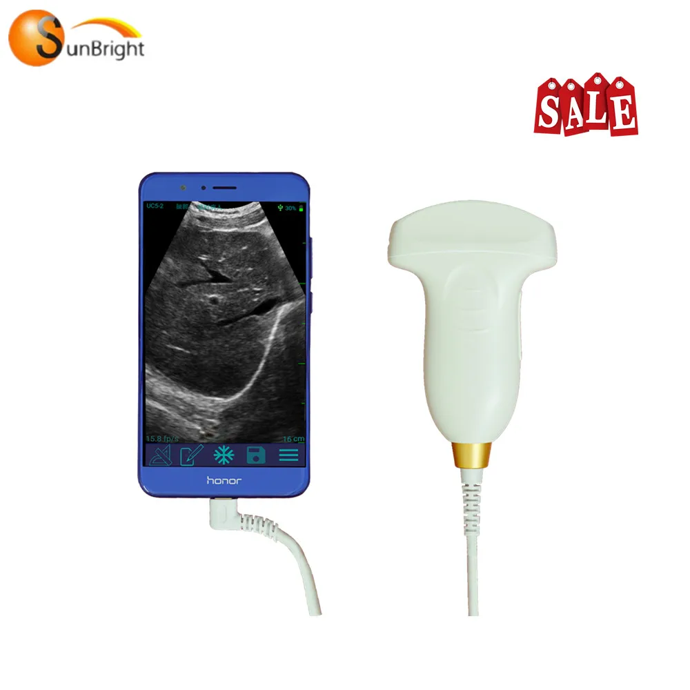 

New arriving hottest pocket USB probe ultrasound for OB GYN