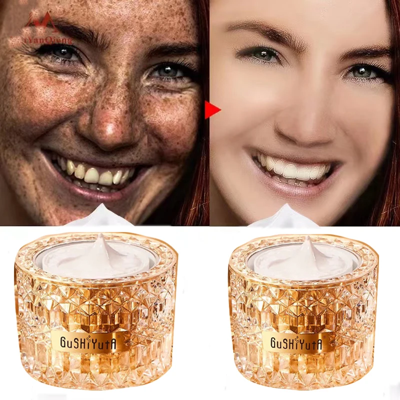 

Whitening Freckle Cream Remove Melasma Cream Remove Dark Spots Melanin Melasma Remover Brighten Skin Anti-Aging Face Cream