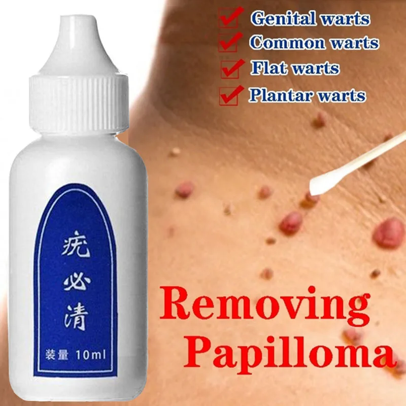 

Skin Tag Remover Genital Wart Treatment Instant Removal Mole&Papillomas Foot Corn Repair Tool Natural Bacteriostatic Liquid