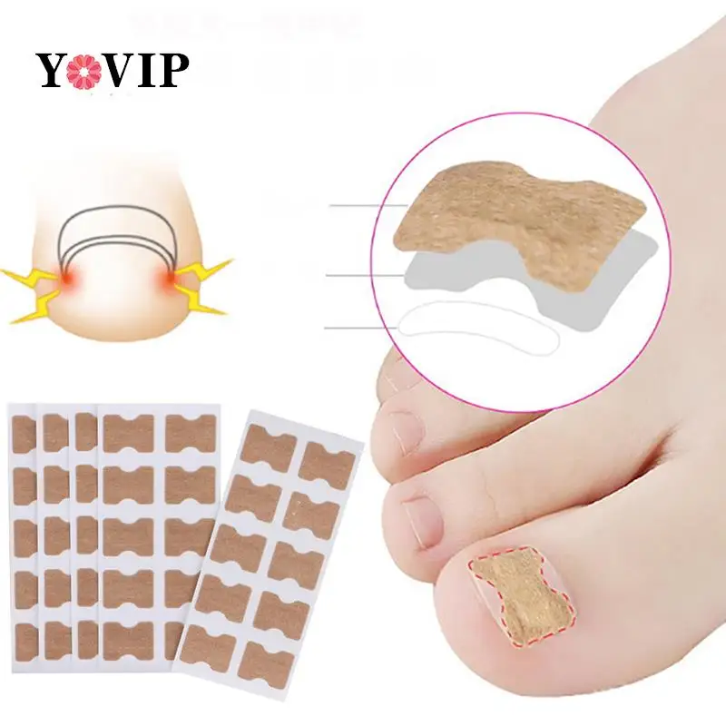 

20/30 шт., корректирующие наклейки для ногтей