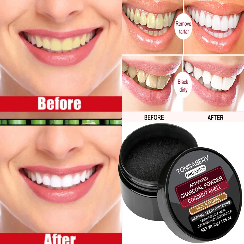 

Эффективный мусс для отбеливания зубов, зубная паста, чистка зубов, гигиена полости рта, удаление пятен, зубной налет, чистка зубов, уход за полостью рта