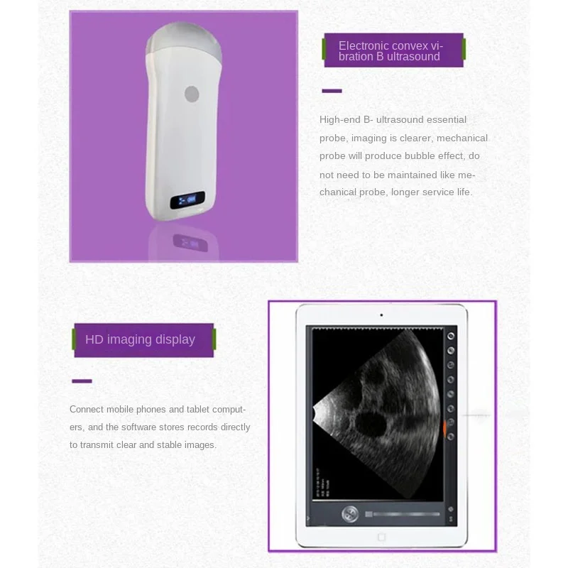Промоакция Andriod IOS система Windows Беспроводной ультразвуковой сканер выпуклая