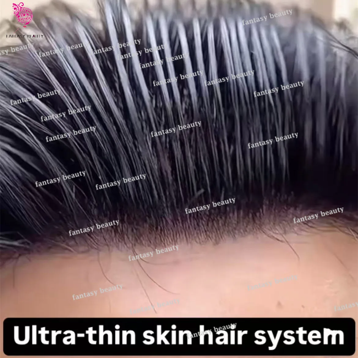 Натуральная линия волос Невидимые капиллярные протезы 0 02 мм Система Черный