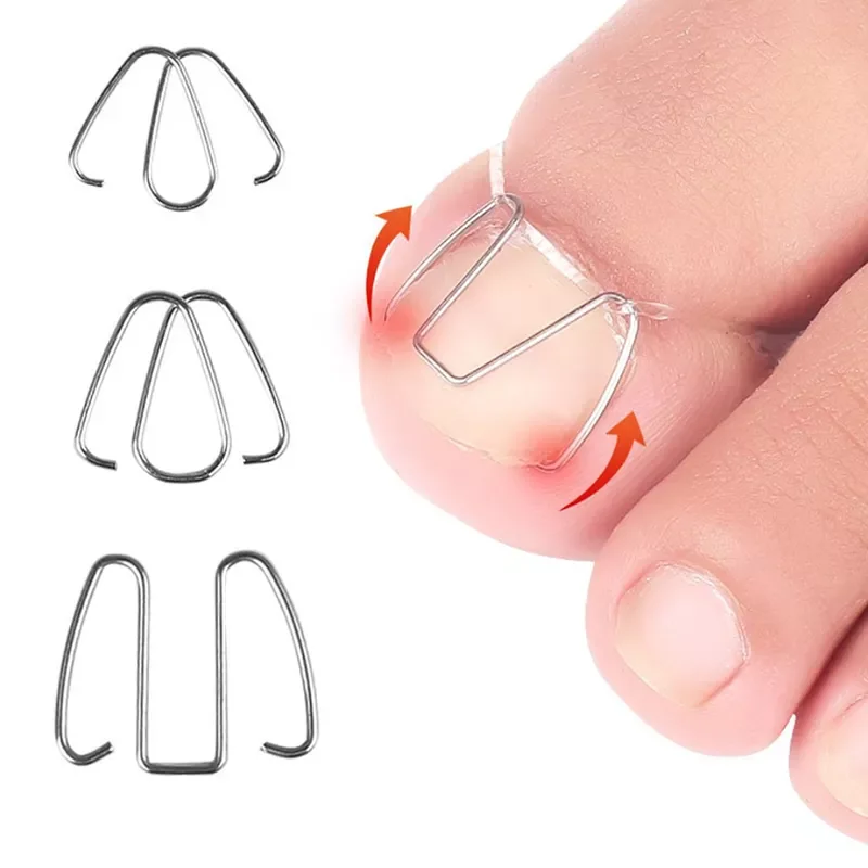 

NEW2023 3Pairs Front nail hook/rubber band Nail Art Ingrown Toe Nail Correction Toenail Nail Ingrown Clip Orthosis Paronychia Pe