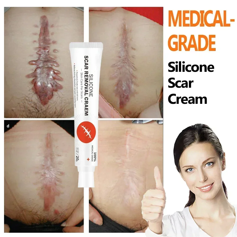 Крем для удаления шрамов средство лечения растяжек сглаживание отбеливание уход