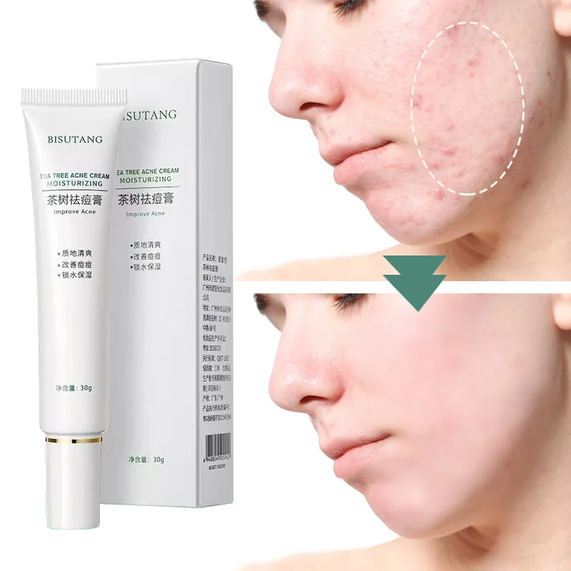 Effective Acne Removal Cream Herbal Pimple Scar Removal Shrink Pore Oil Control Moisturizing Facial Cream Treatment Skin Care