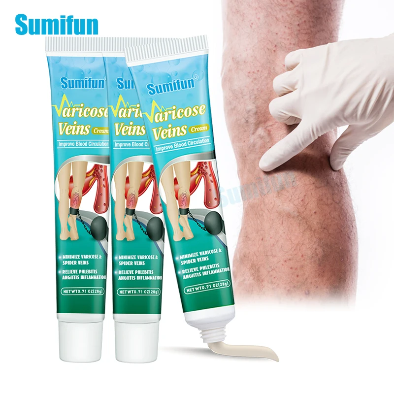 

3pcs Dropshipping Sumifun Varicose Veins Cream Phlebitis Vasculitis Care Ointment Varicosity Thigh Spider Pain Relief Plaster
