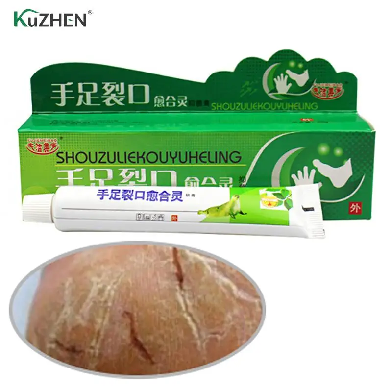 

Мощный ручной от трещин на ногах крем на ороговевшей кожи пилинг для рук и ног ремонт анти-сухая трещина по уходу за кожей китайская мазь