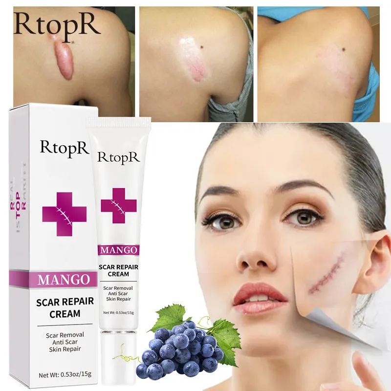 

Крем для удаления шрамов и акне, от шрамов