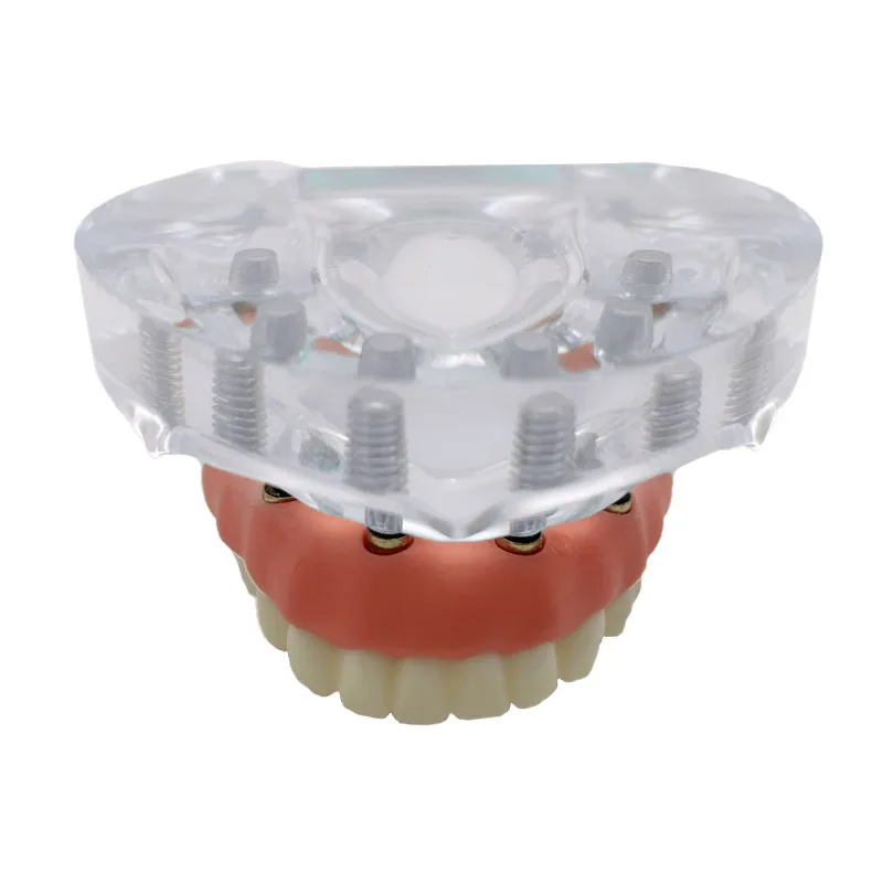 1 шт. модель зубного имплантата 6 имплантатов реставрация зубов стоматолог