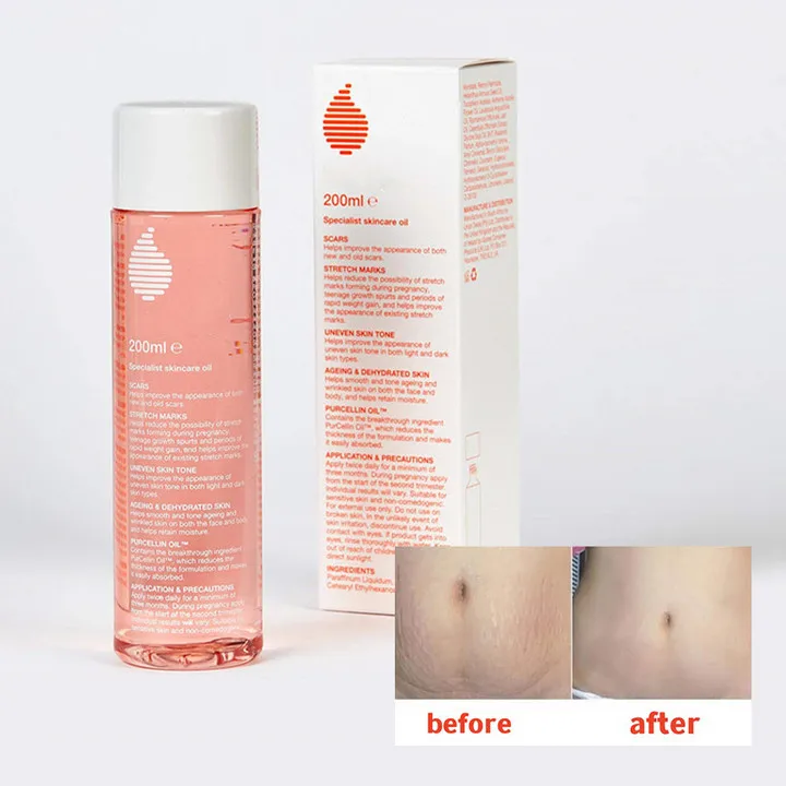 

Bio Oil Fade Stretch Marks Pregnant Women Prevent Wrinkles Specialized Essence Oil Prenatal Prevention Repair Scars Skin 200ML