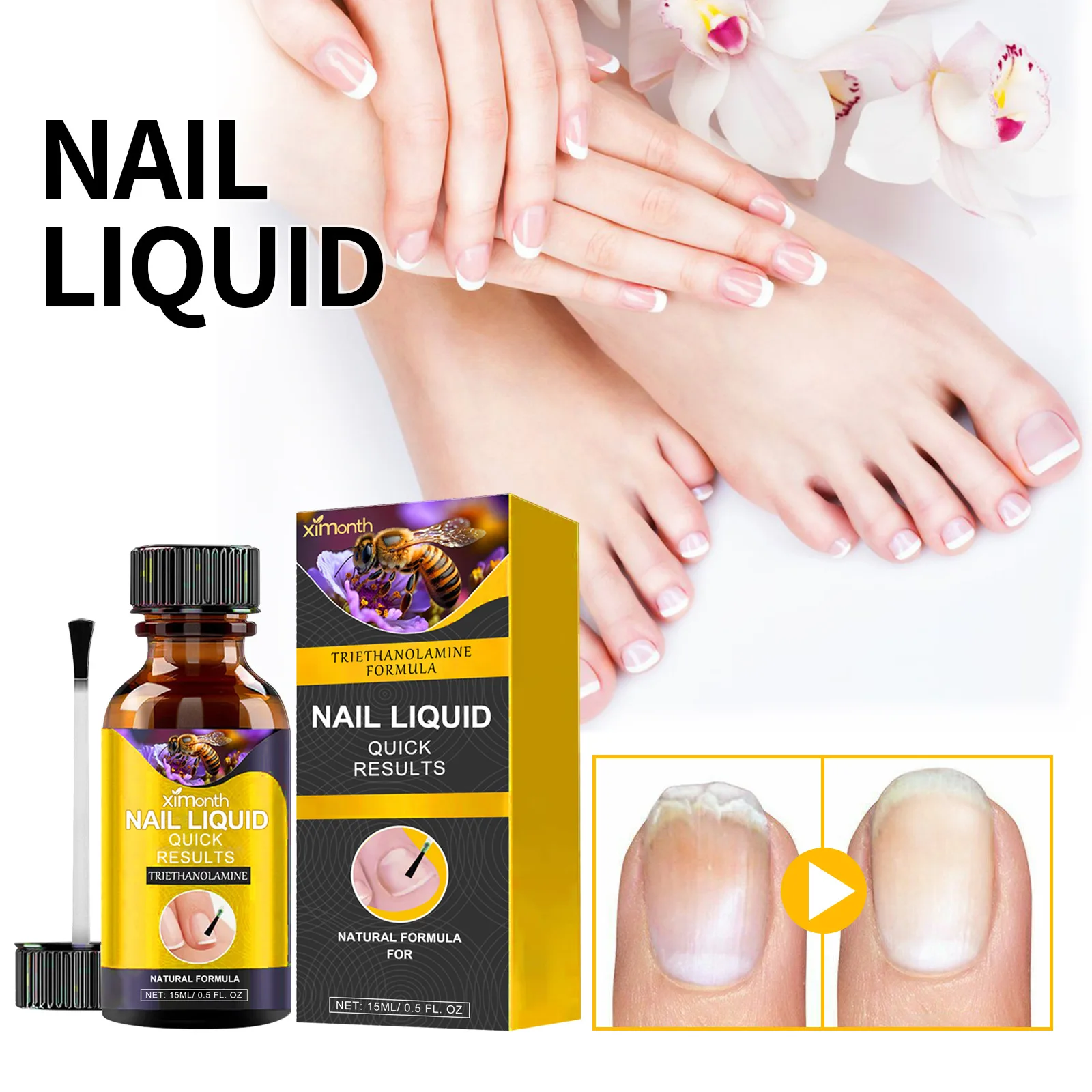 онихомикоз удаление рук ног ремонт уход за ногтями лечение грибка паронихии