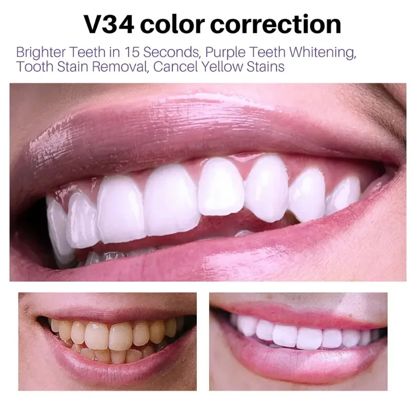 Фиолетовая отбеливающая зубная паста V34 Smilekit удаляет пятна уменьшает желтые