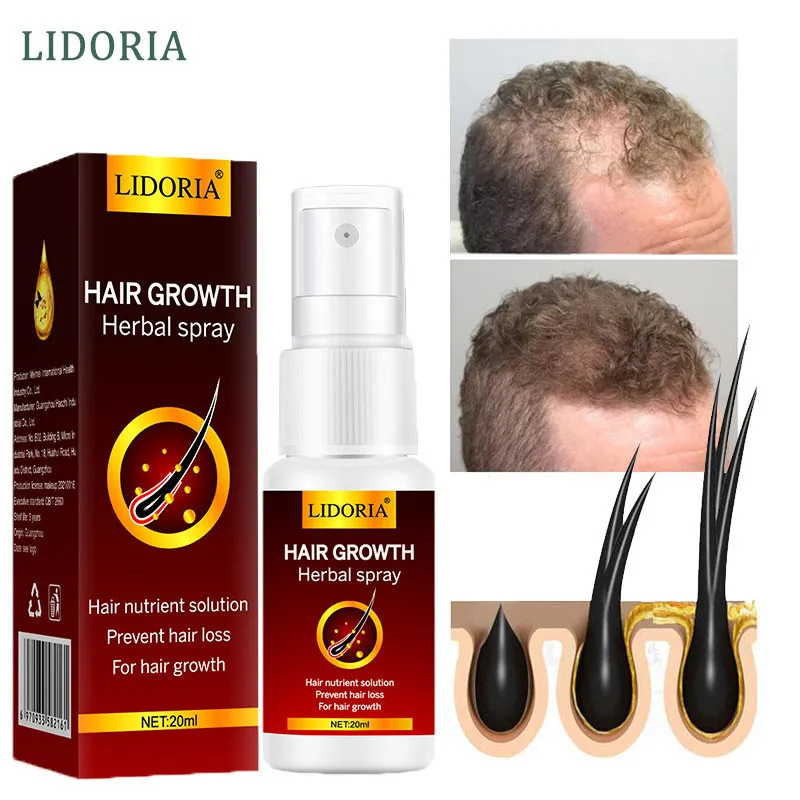 Ginger Hair Growth Spray Oil Fast Hair Regrowth Essence Prevent Hair Loss Serum Liquid Bald Scalp Treatment For Men Women 20ml