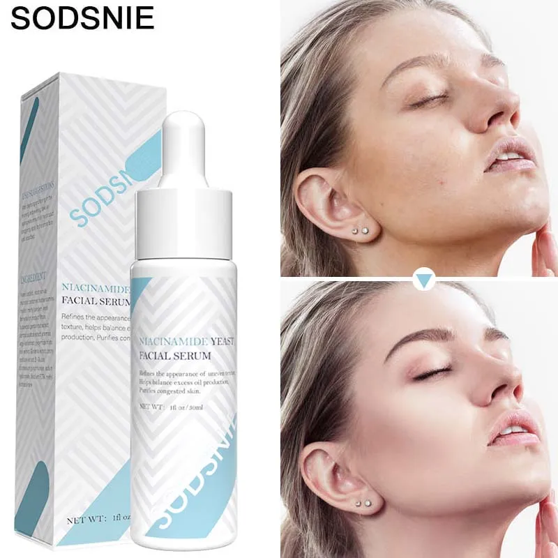 

Niacinamide Yeast Serum Whitening Brighten Fade Spot Skin Care Products Moisturizing Nourishing Shrink Pores Beauty Cosmetics
