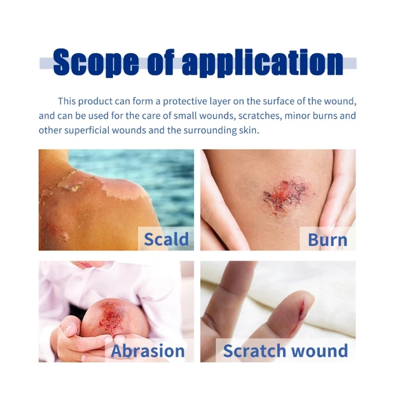 Кровоостанавливающая повязка Марля для остановки кровотечения Бинты