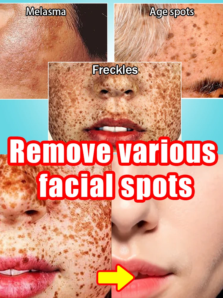 ʸ ᵒᵉ ᵉ ᵒ ˢ ᵃᵃᵃᵃᵃᵃᵃᵃ