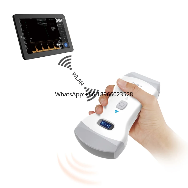 Высокопроизводительная электронная ультразвуковая установка цена электронной