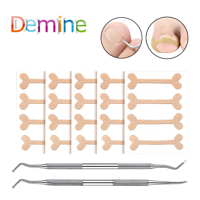 

Ingrown Toenails Band Aid Relief Pain Paronychia Correction Pedicure Elastic Force Sticker Repair Bandage Toe Nail Care Toe Pads