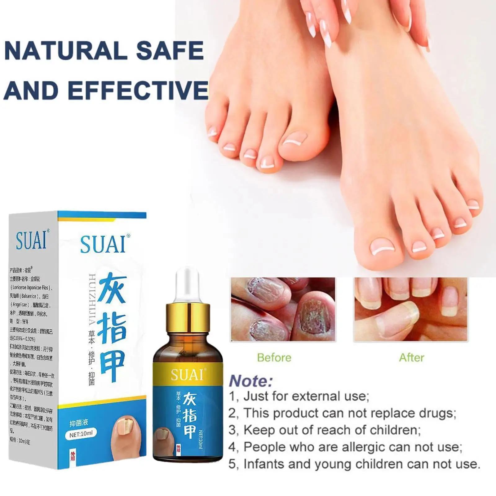 

Лечение грибковых ногтей, сыворотка для восстановления ногтей, онихомикоз, паронихия, грибок для ног, противогрибковое удаление ногтей, про...