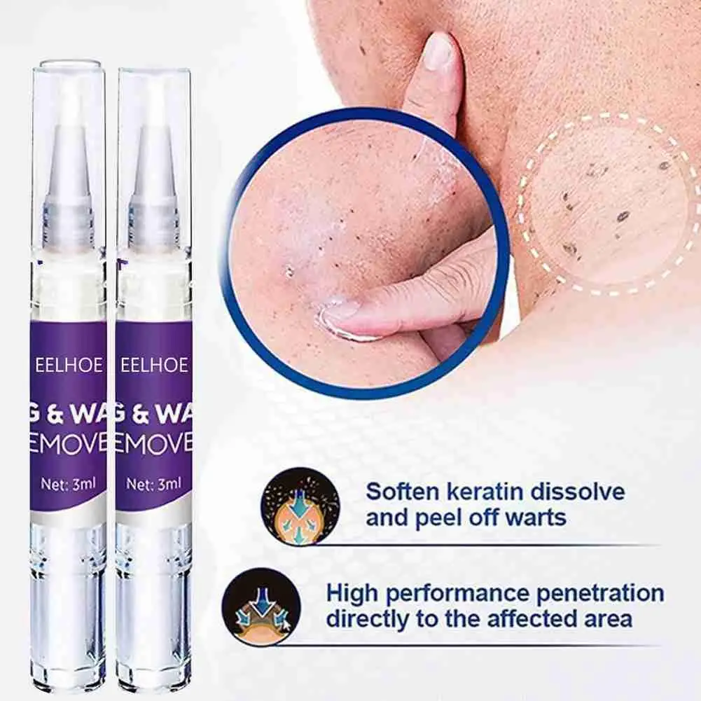 

Warts Flat Warts Skin Repair Without Trace Beauty Liquid Skin Treatment Papilloma Of Wart Removal Warts Mole Pen