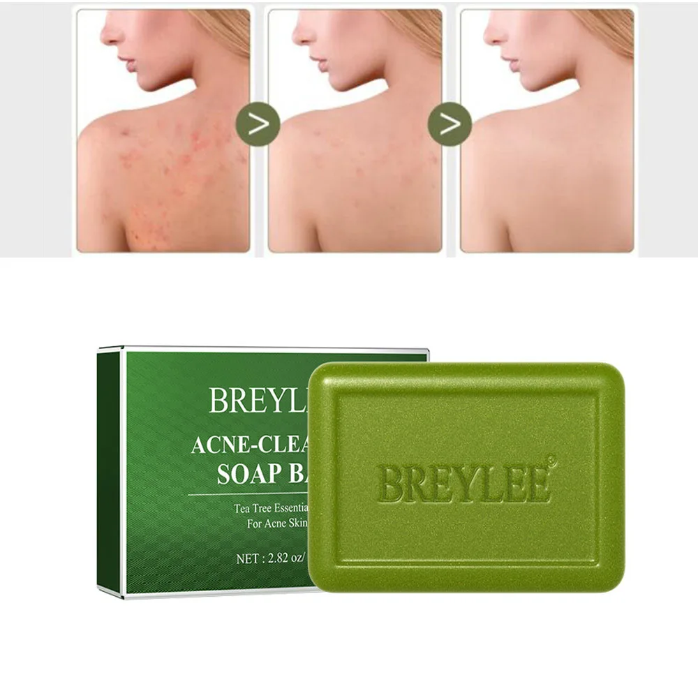 Tea Tree Soap Bars for Dry Sensitive Skin Natural Soap Softening Skin Whitening Soap Acne Fighting Great for Face Body Handmade