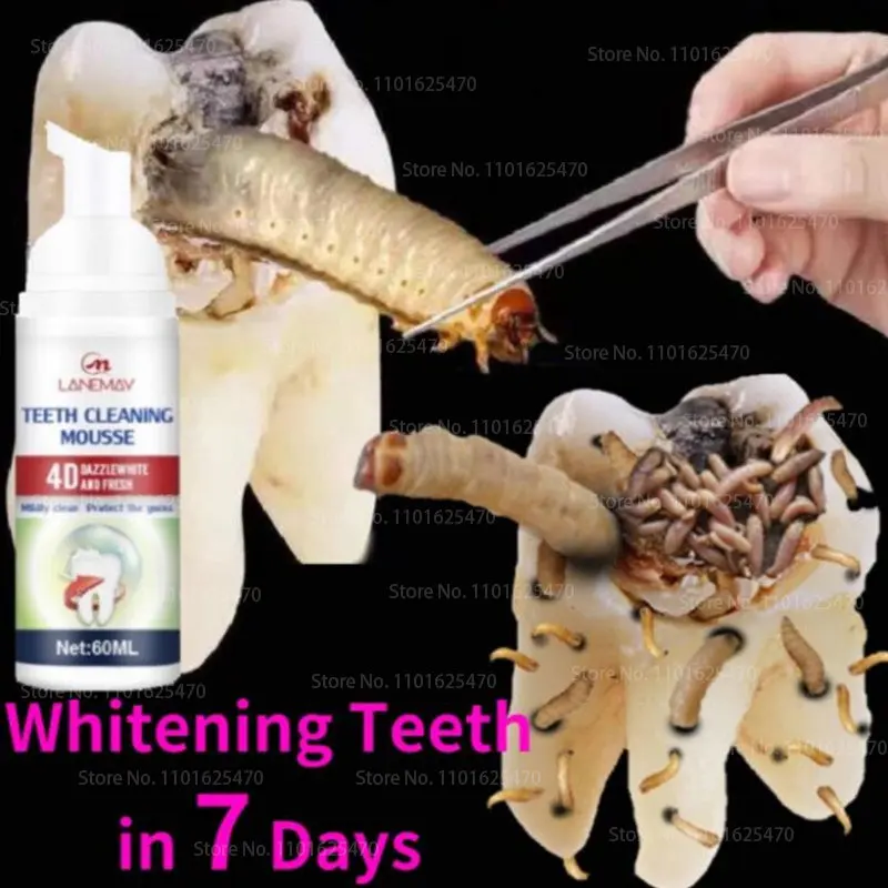 

Tooth Whitening Mousse Toothpaste Can Quickly Repair Dental Caries, Remove Dental Plaque, Stain, Bad Breath, and Whiten Teeth