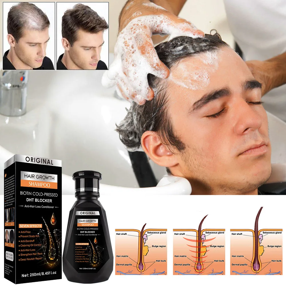 

250ml Hair Growth Shampoo Anti Hair Loss Fast Grow Nourish Scalp Soft Hair Dandruff Oil-control Natural Repair Growing Treatment