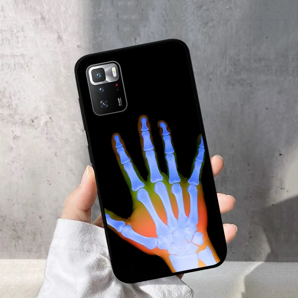 Радиологический каркас человеческих органов телефон планшетофон X 5 A 6 7 8 Pro T9 9S 10 11