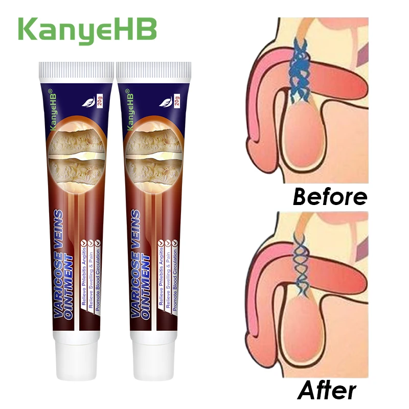 Крем от варикозного расширения вен мужской 2 шт.